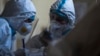 Ukraine -- hospital, department of patients with coivd-19, Lavriv, lviv region, 5 April 2021